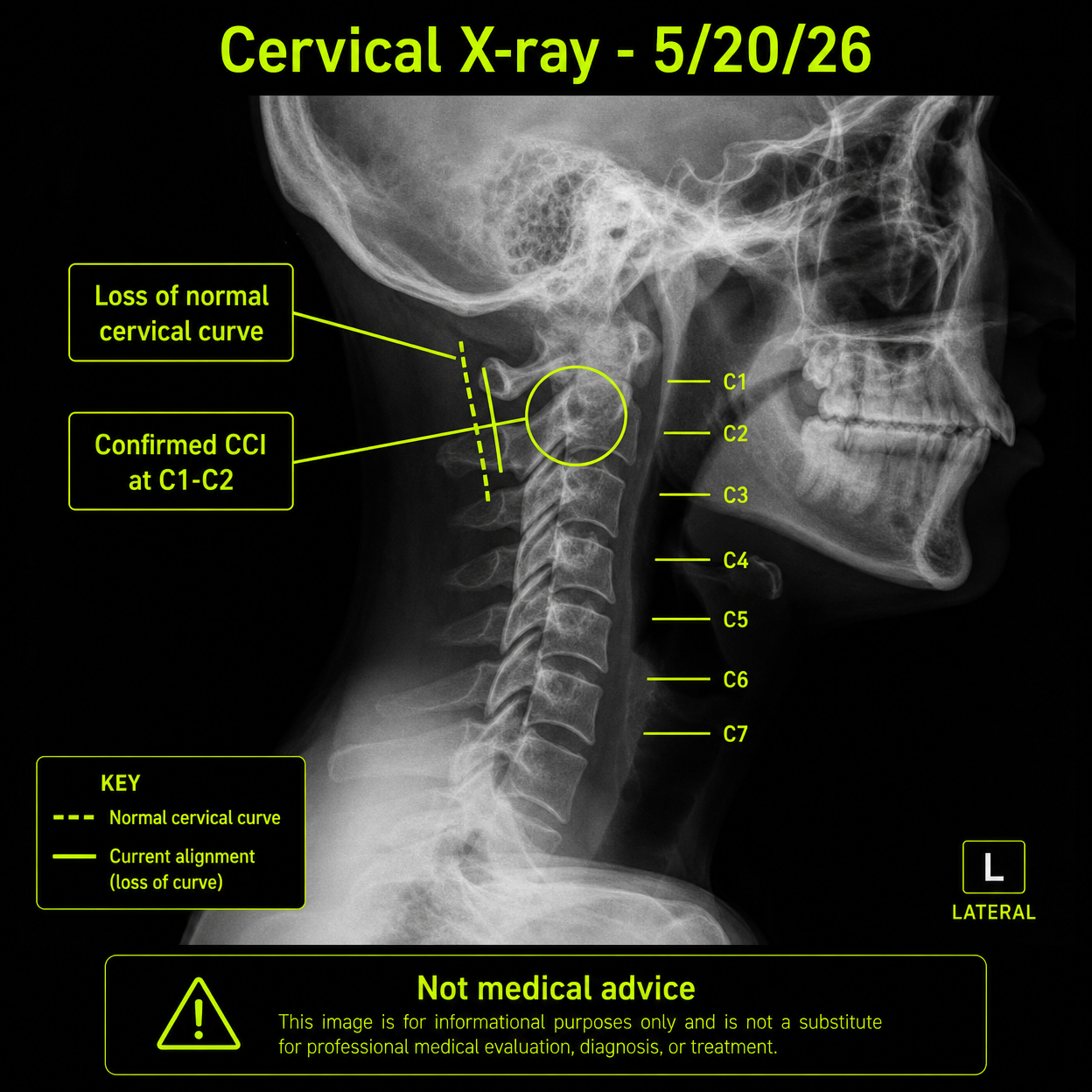 Blair Upper Cervical