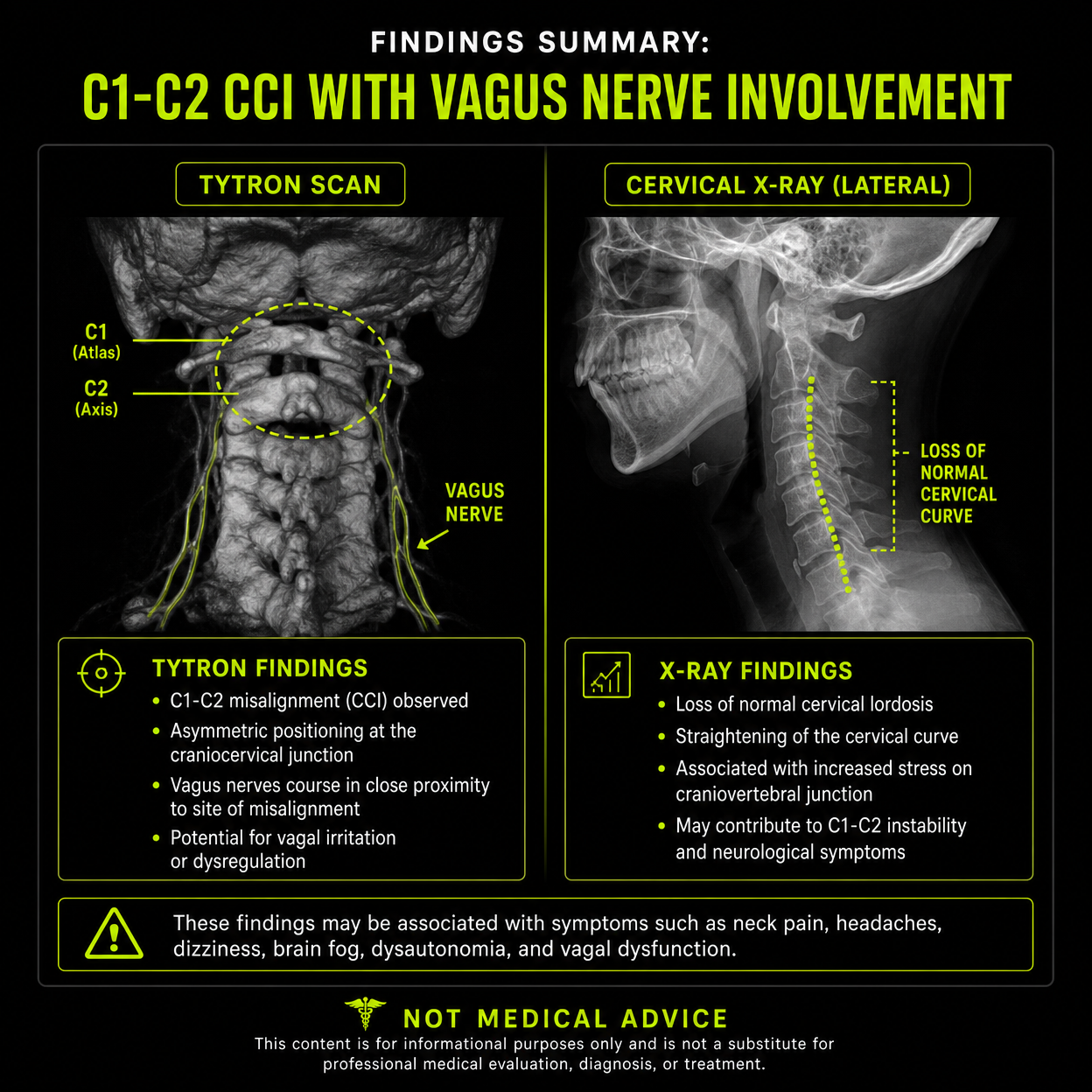 Dre's C1-C2 Instability Cervical X-ray and TyTron Scan findings