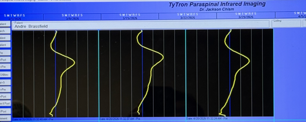 TyTron Scan Proof